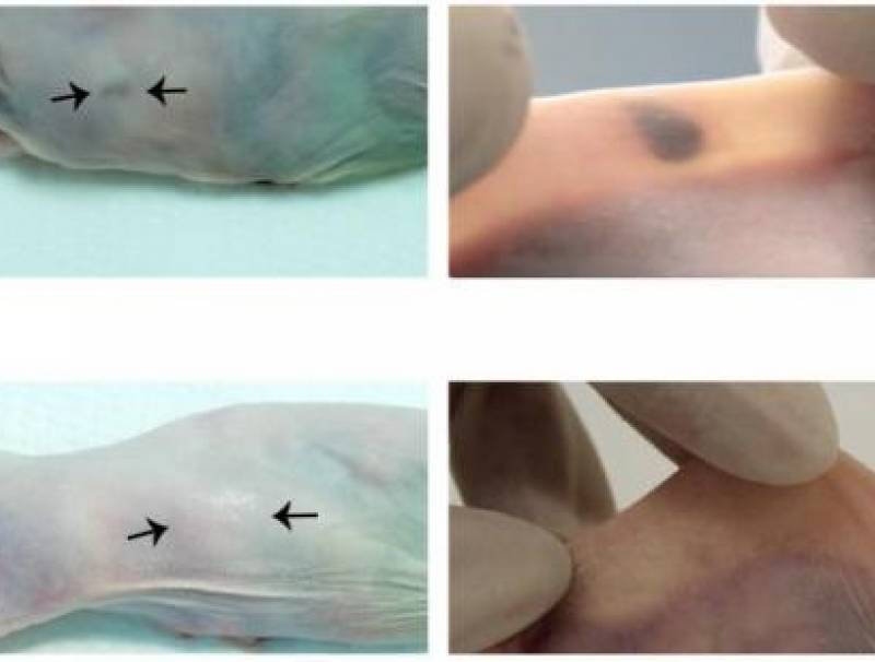 Un « tatouage biomédical » détecte précocement l'hypercalcémie associée au cancer chez la souris